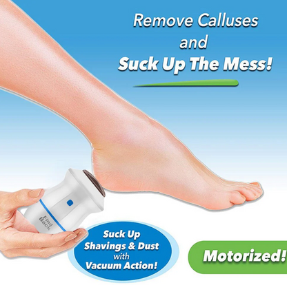 Removedor Eléctrico de Callos para Pies