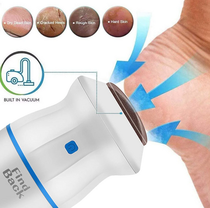 Removedor Eléctrico de Callos para Pies